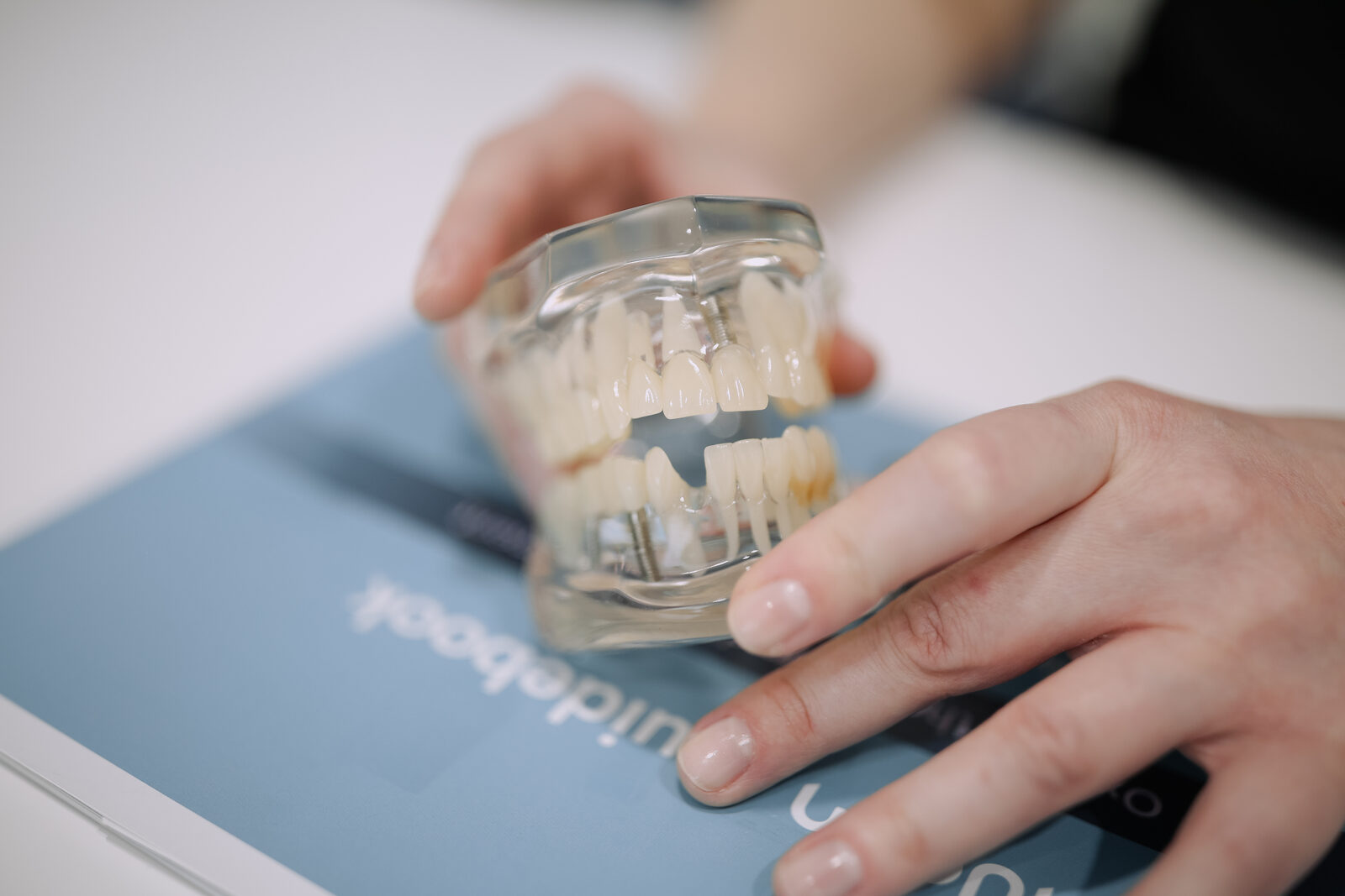 Implantul dentar